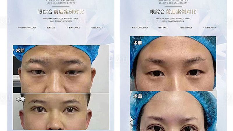 2025医美品牌排行榜：揭秘行业趋势与选择标准