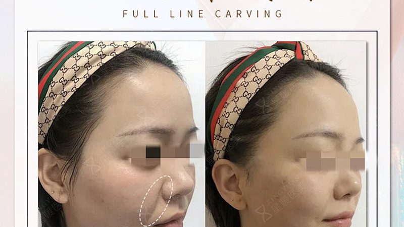 揭秘上海抗衰品牌门店排名背后的秘密