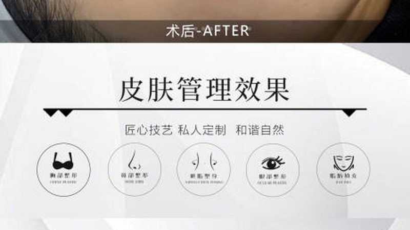 医美术后祛红修复霜：揭秘其作用与正确使用方法