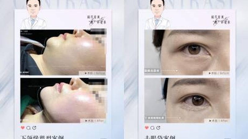 皮肤管理与医美：别再傻傻分不清