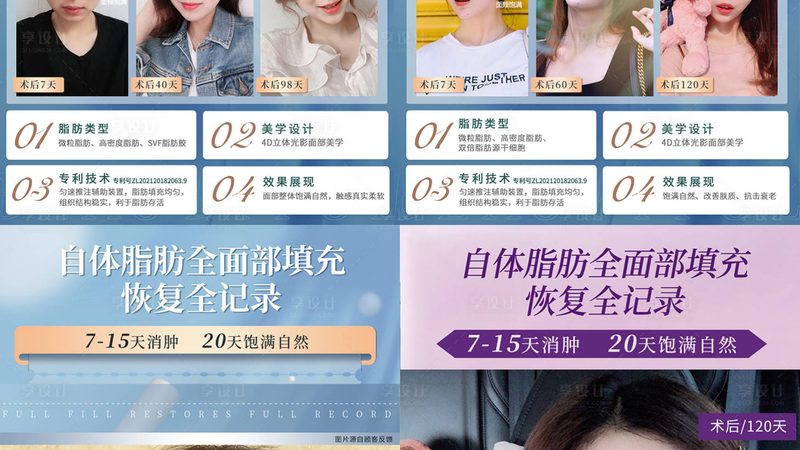 脂肪填充和线雕，抗衰思路完全不同