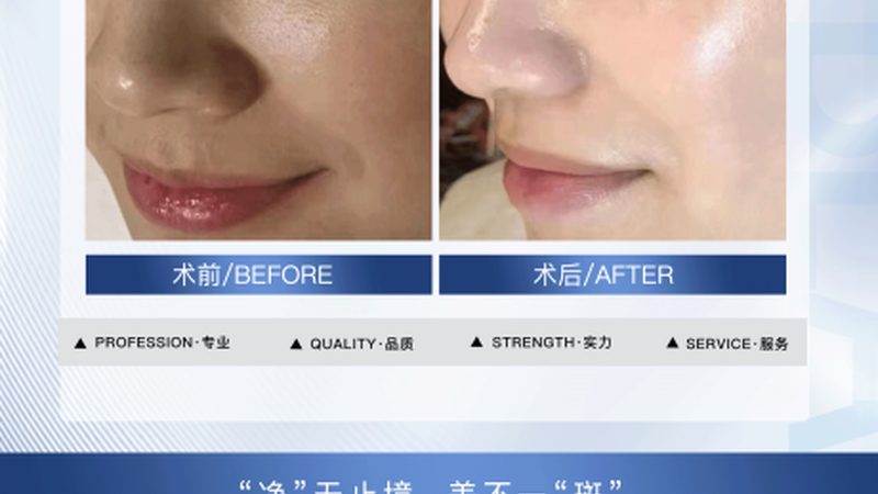 瘦脸操前后，这些产品你不可不知