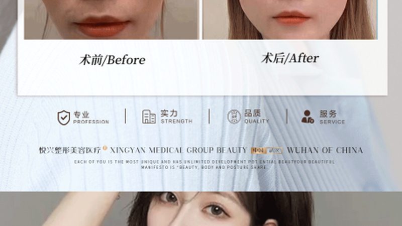 热玛吉代理加盟费背后，藏着哪些行业真相