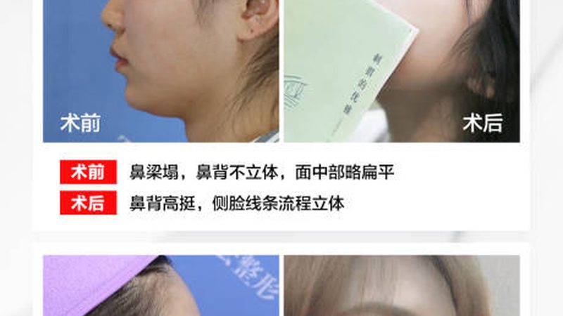 30天瘦脸操，效果如何？揭秘瘦脸操的真相与误区**