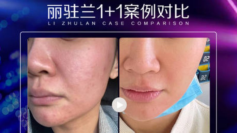 热玛吉代理加盟：别只看品牌，先看懂行业逻辑