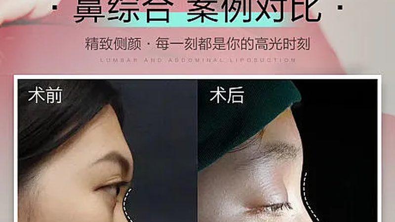 轻医美微整形哪家医院好