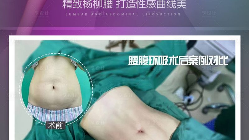 双眼皮修复：失败手术后的关键注意事项**