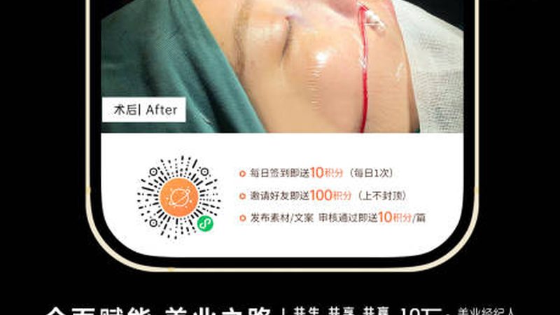 成都激光祛斑仪器：揭秘其原理与选购要点
