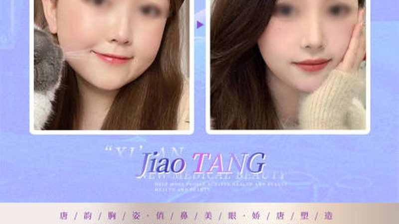 热玛吉2025：揭秘价格背后的秘密**