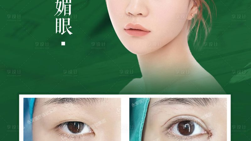 超声炮术后护理全攻略，让你的美丽更放心