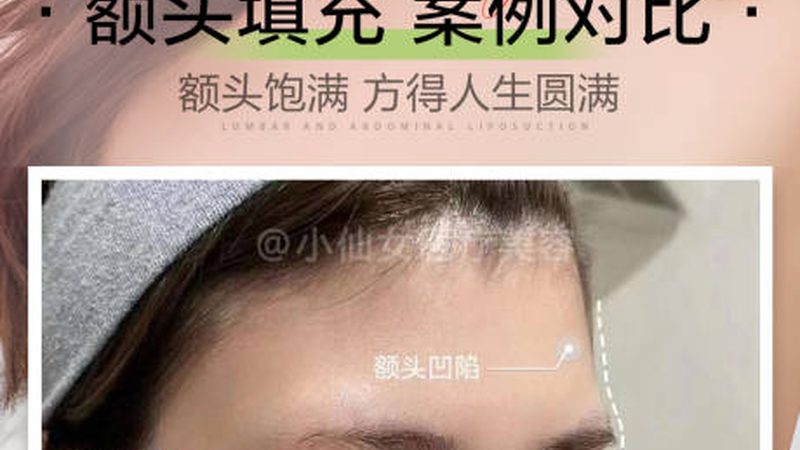 激光祛斑疗程，揭秘有效次数的真相