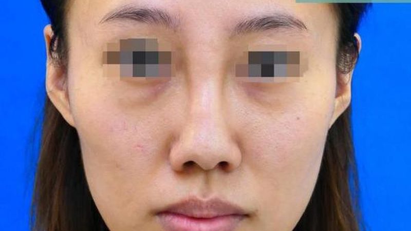 轻医美产品OEM定制，厂家到底在做什么